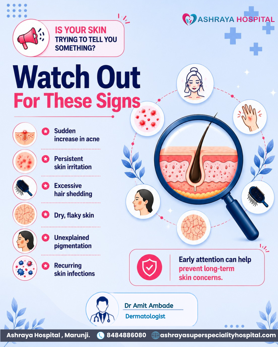 Watch Out for these things.