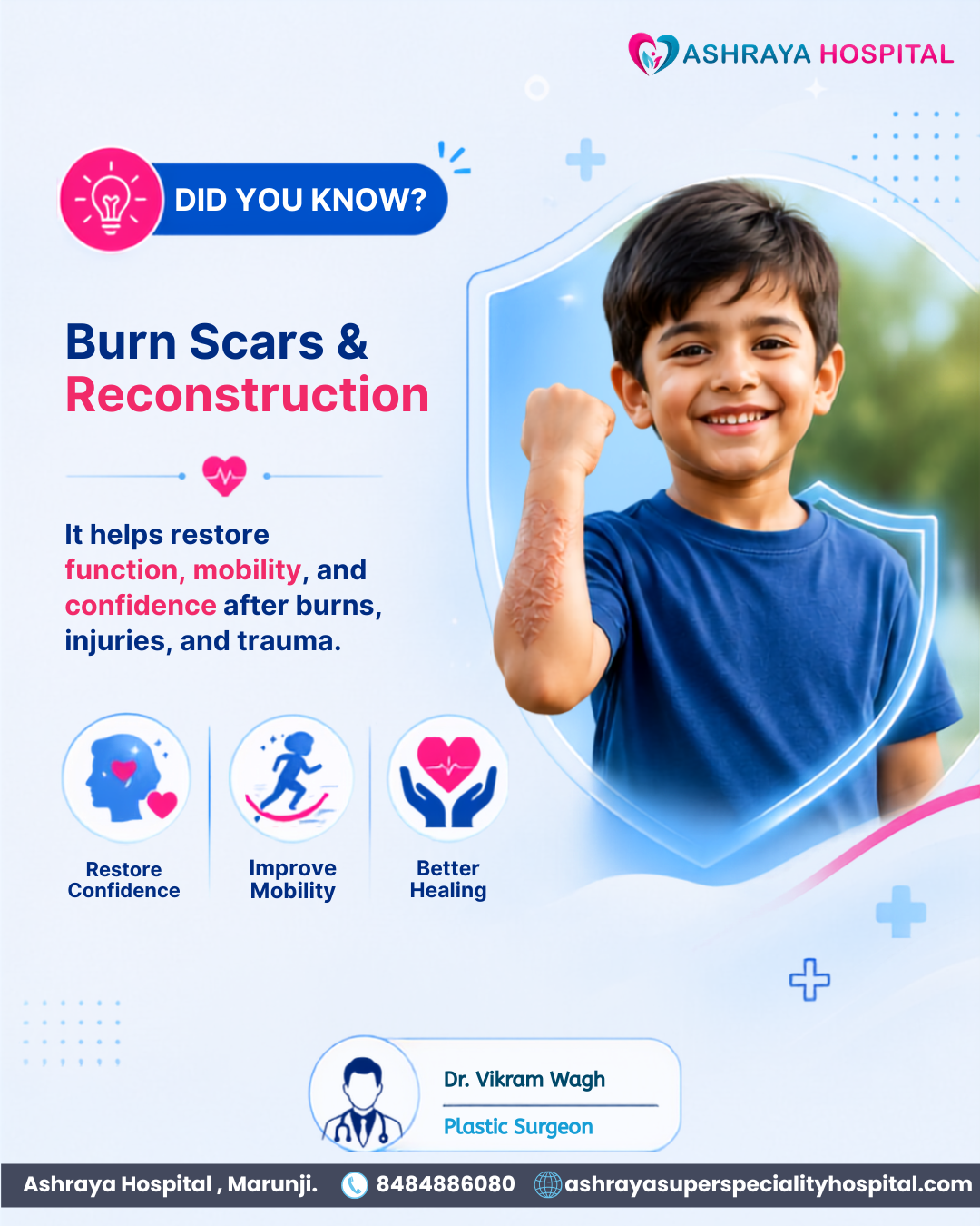 Did you know about Buen Scar & it's reconstruction